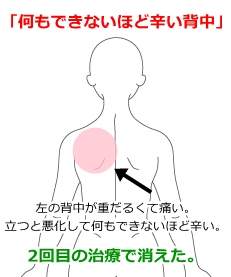 痛み 左 背中