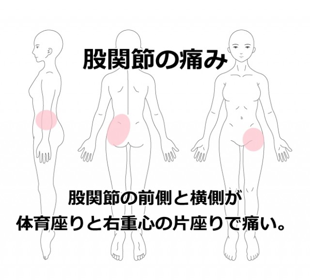 股関節の痛み 鹿沼市の鍼 はり ますぶちマッサージ はり きゅう治療院