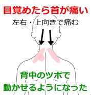 首の痛み 寝違え ムチウチ 鹿沼市の鍼 はり ますぶちマッサージ はり きゅう治療院