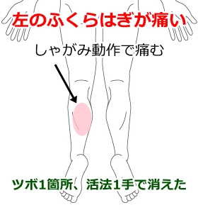 坐骨神経痛 足の痛みしびれ 鹿沼市の鍼 はり ますぶちマッサージ はり きゅう治療院