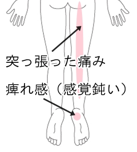 あし の うら の 痺れ