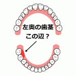 【鍼×活法と歯茎の痛み】の詳細へ