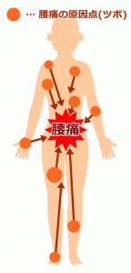 腰痛の原因点(ツボ)は全身にある