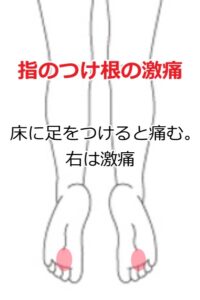 足底の痛み7