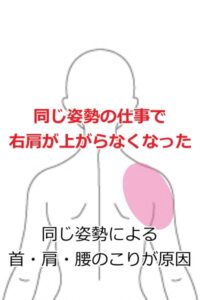 五十肩の症例15